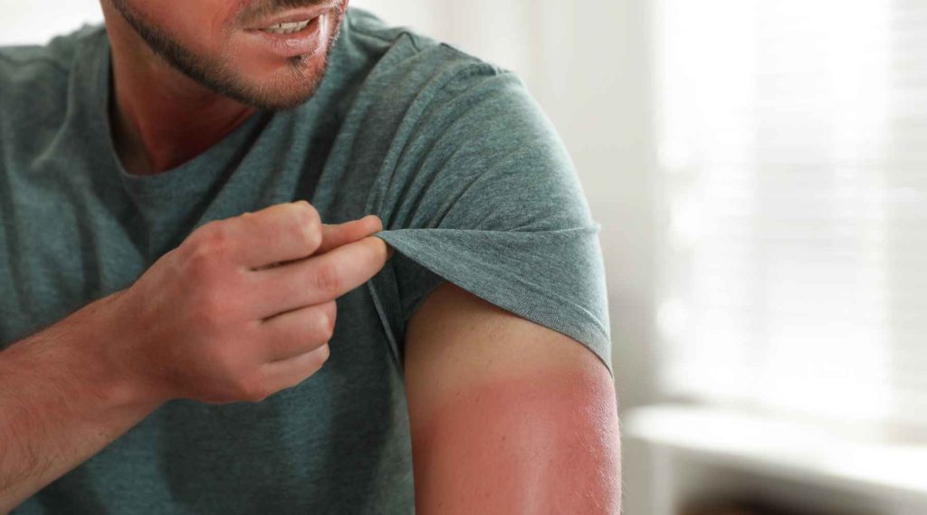 شایع ترین بیماری های پوستی و آفتاب سوختگی پوست