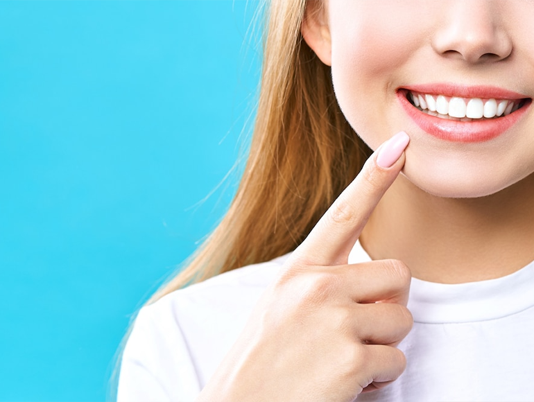 Get a Perfect Smile: Hollywood Smile, Teeth Whitening & More